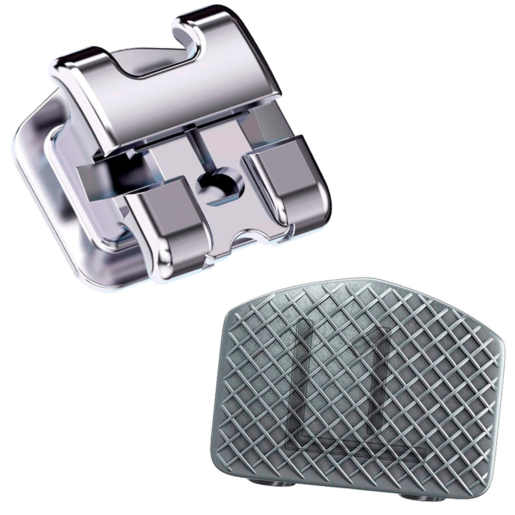 1 Caso Brackets Autoligado OrthoClip SLB UltraP Orthometric Biotech Chile